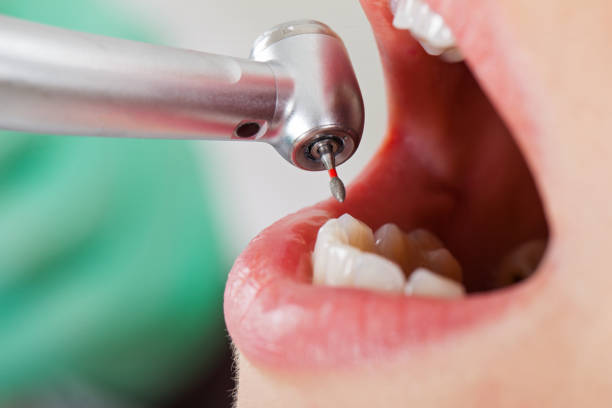 Best Emergency Dental Care for Sports Injuries in Comstock Park, MI